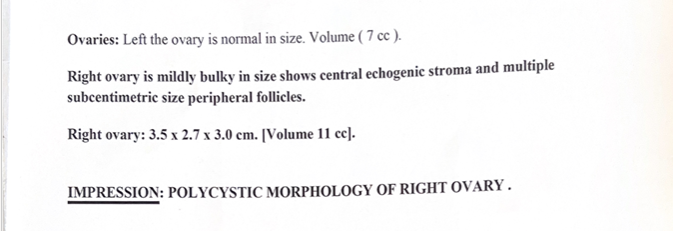 Ultrasound report showing polycystic morphology of the right ovary, with right ovary mildly bulky at 3.5 x 2.7 x 3.0 cm, volume 11 cc, with multiple subcentimetric peripheral follicles