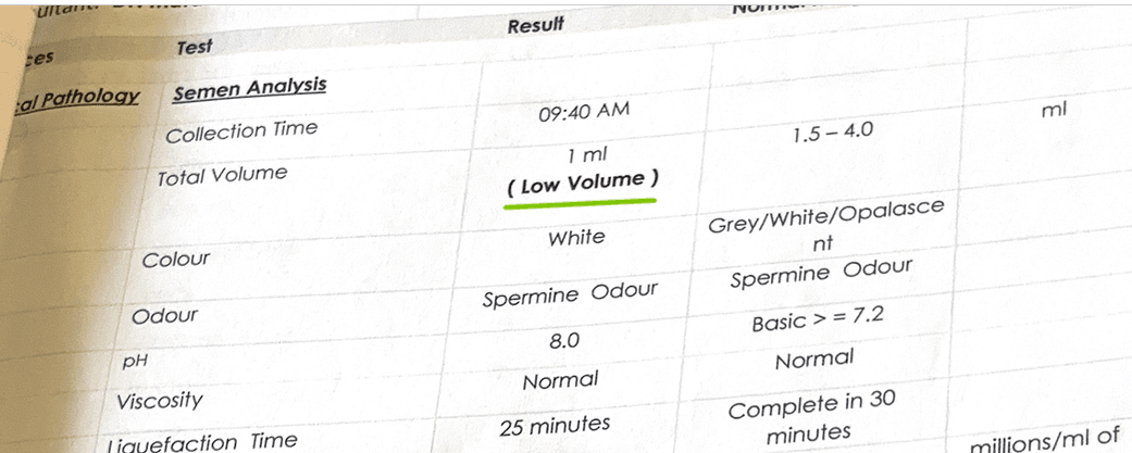 Semen analysis report showing low volume of 1 mL