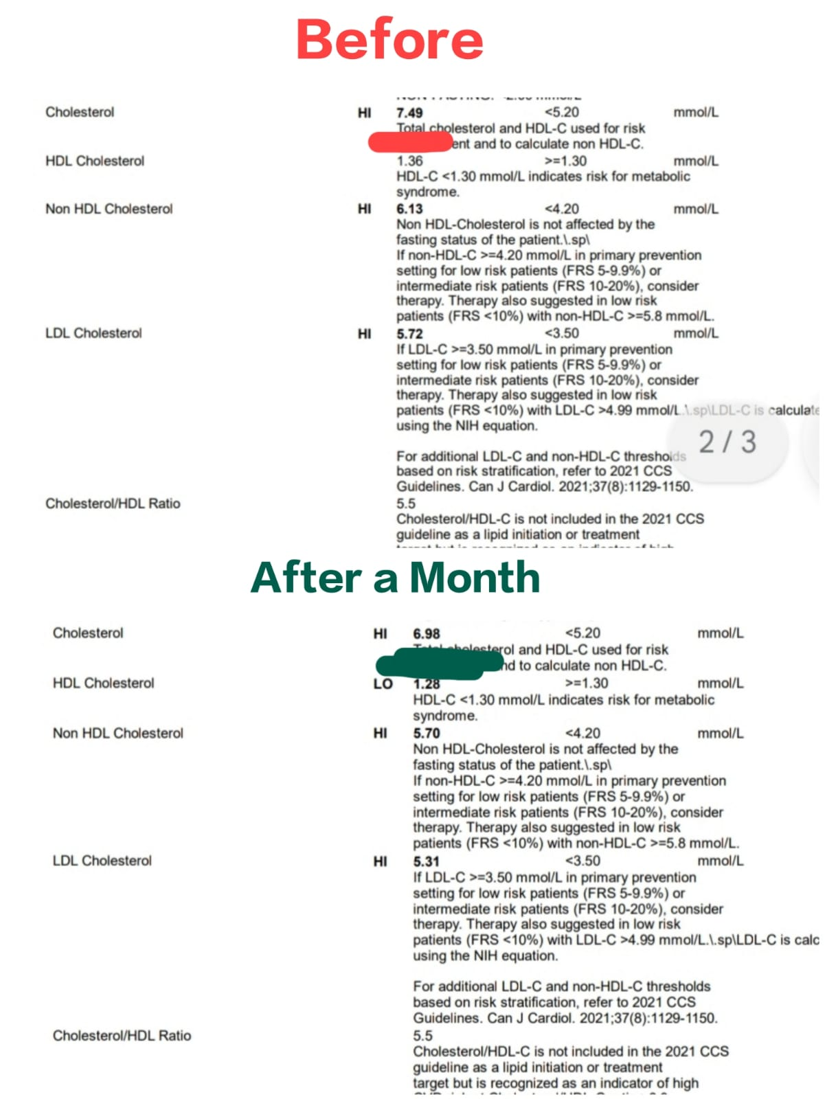 Nandhini's before and after lipid panels from her Canadian lab, one month apart: total cholesterol from 7.49 to 6.98 mmol/L, LDL from 5.72 to 5.31, non-HDL from 6.13 to 5.70