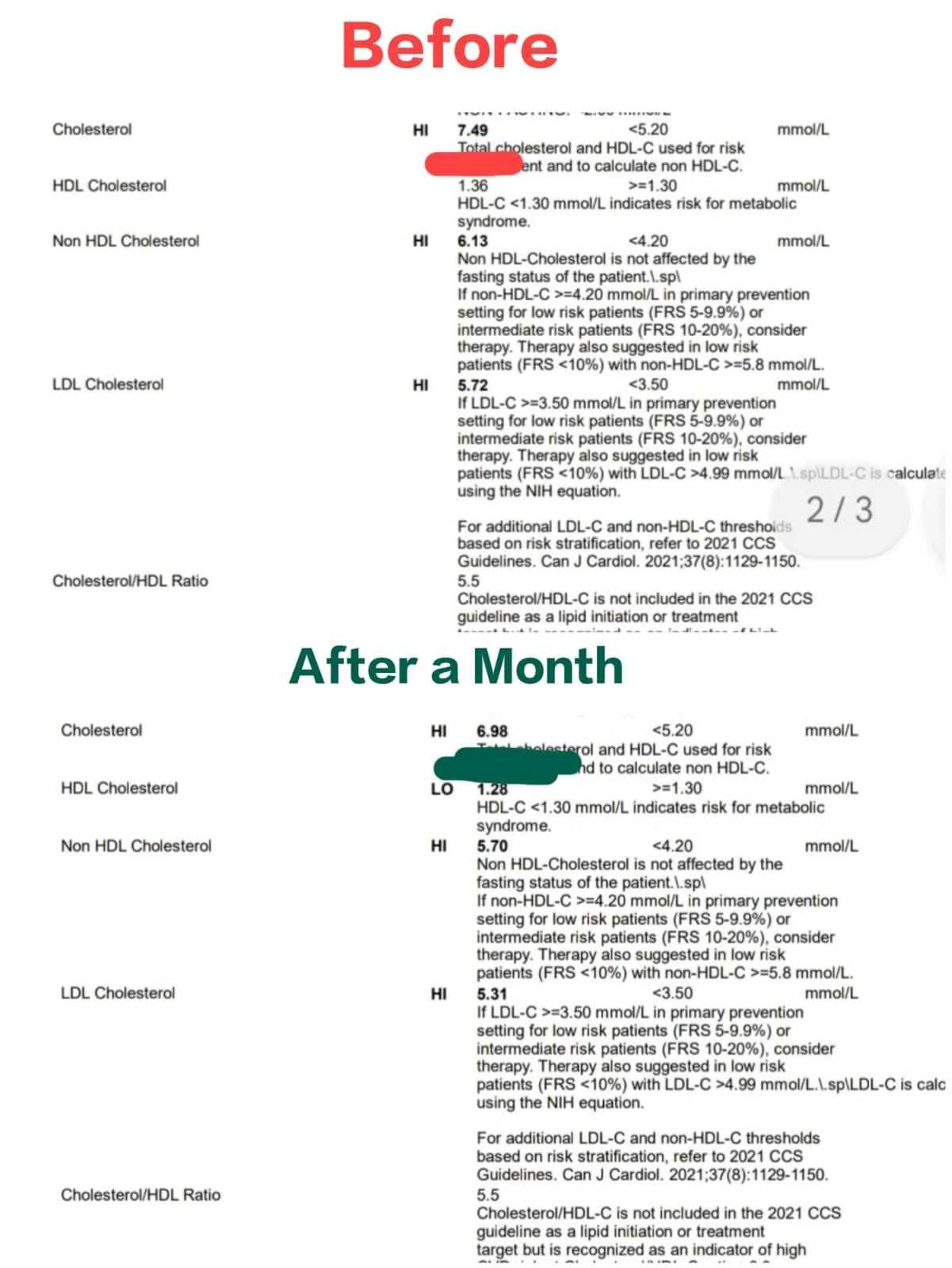 Nandhini's before and after lipid panels from her Canadian lab, one month apart: total cholesterol from 7.49 to 6.98 mmol/L, LDL from 5.72 to 5.31, non-HDL from 6.13 to 5.70