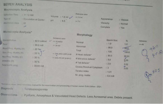 Husband's semen analysis showing teratozoospermia with 1% normal morphology and predominant head defects