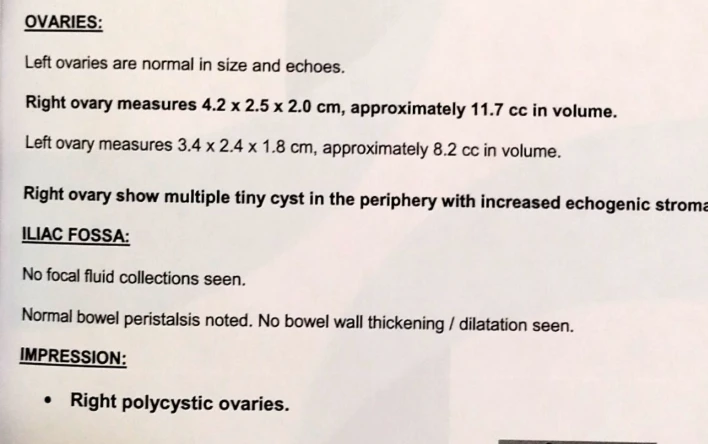 Ultrasound report showing right polycystic ovaries with multiple tiny cysts in the periphery and increased echogenic stroma