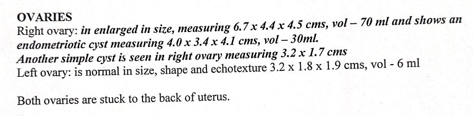 Ultrasound report showing right ovary enlarged with endometriotic cyst measuring 4.0 x 3.4 x 4.1 cms, both ovaries stuck to the back of uterus