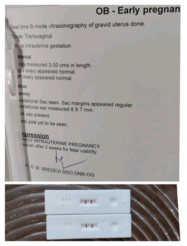 Ultrasound report confirming early pregnancy plus positive home pregnancy test